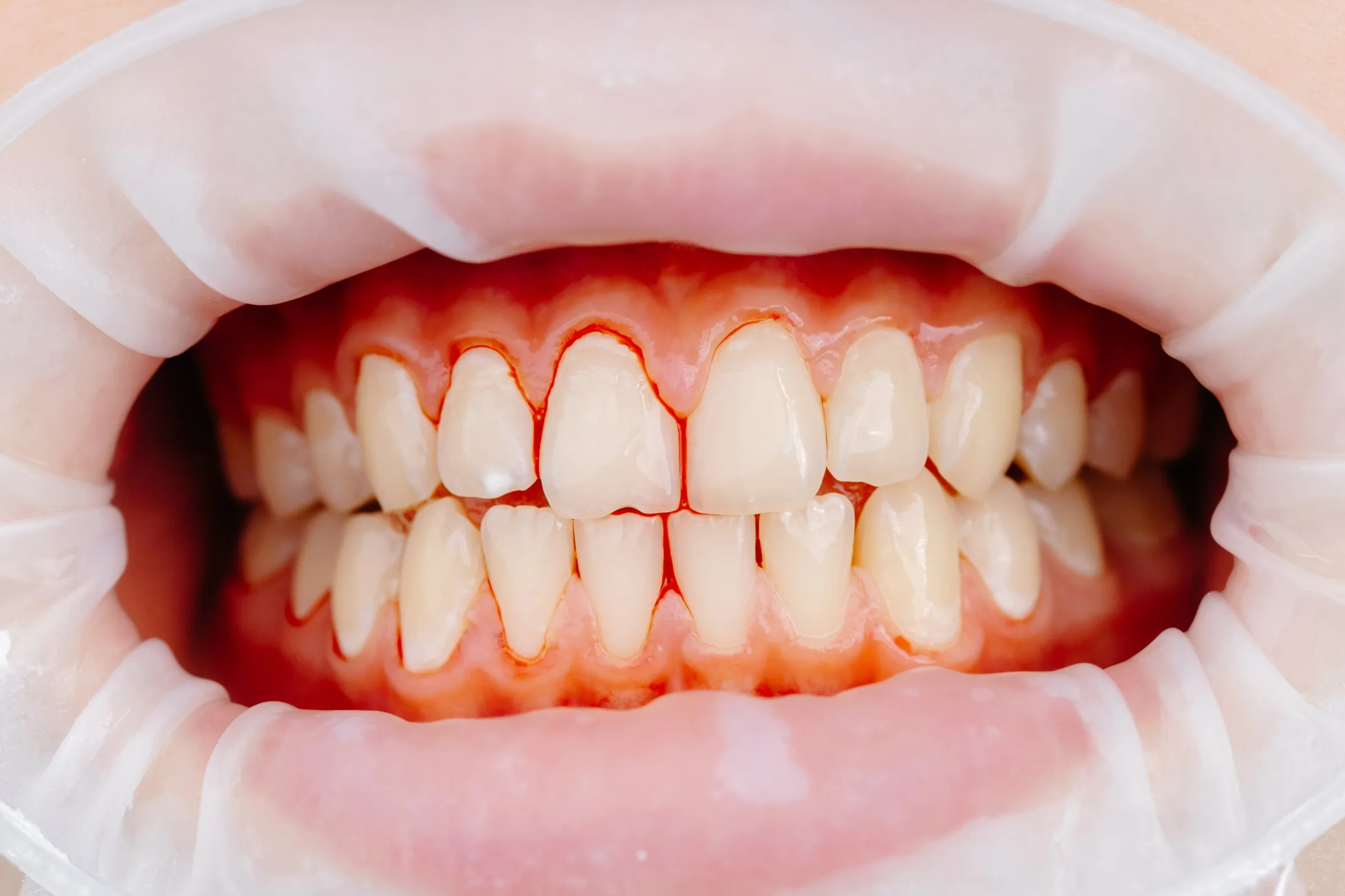 Patient case study