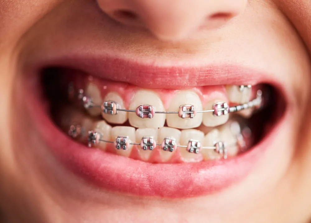 Patient case study
