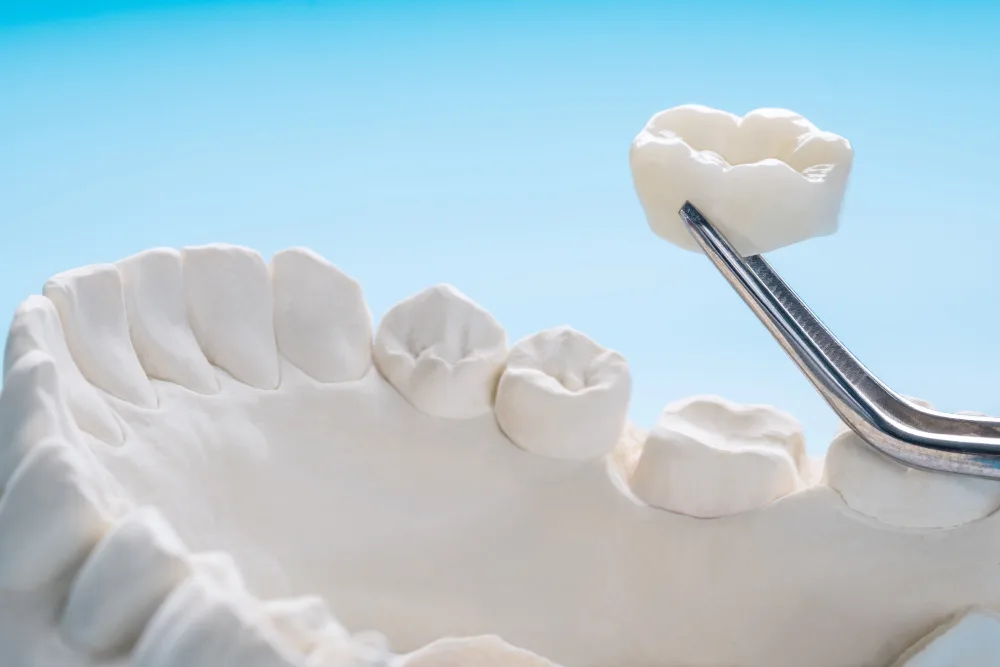 Dentist performing dental crowns procedure