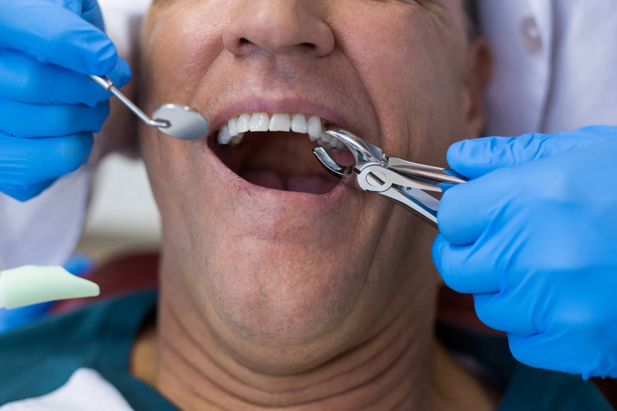 Dentist performing extraction & oral surgery procedure