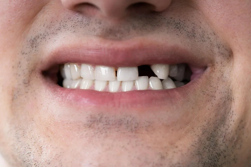 Dentist performing dental implants procedure