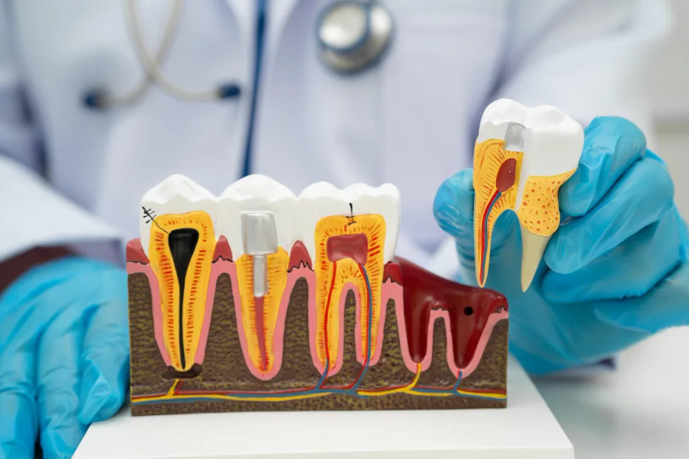 Dentist performing root canal treatment procedure