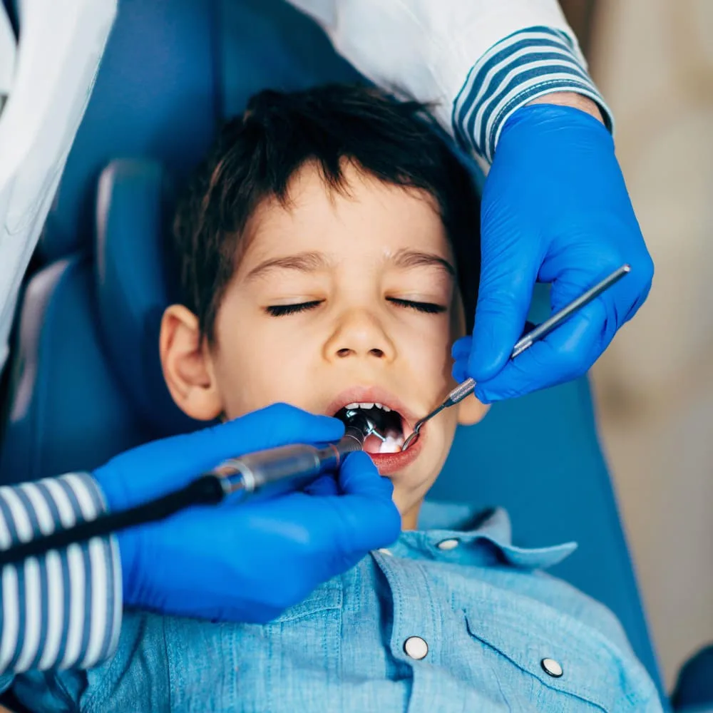 White Fillings at Studio Dentale