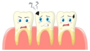 Teeth Problems
