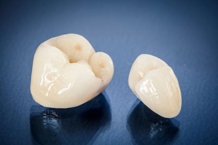 TIPS FOR PROPER DENTAL CROWN CARE