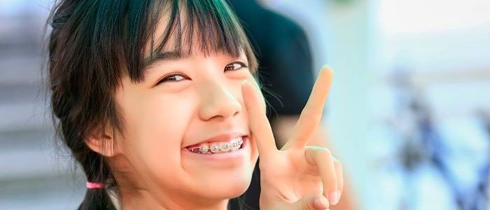 DOES MY CHILD NEED BRACES?