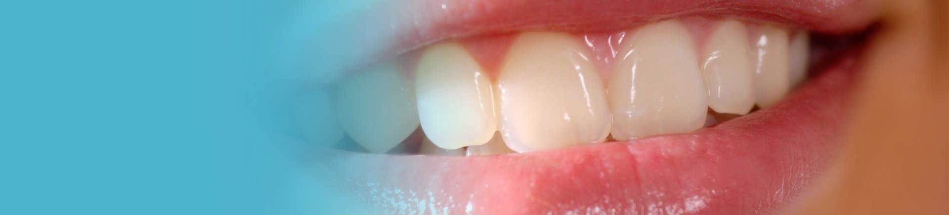 Why Professional Dental Cleaning is Important for Long-Term Oral Health