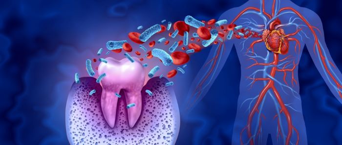 THE LINK BETWEEN ORAL HEALTH AND HEART DISEASE