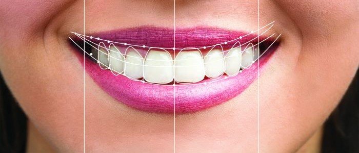 Design Your Dream Smile: The Power of Virtual Smile Design