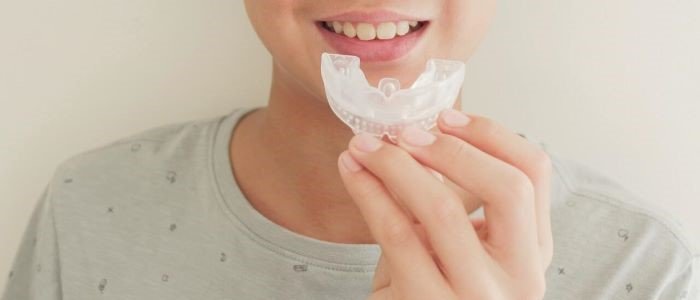 Protect Your Smile: 5 Reasons to Use Mouthguards in Sports Activities