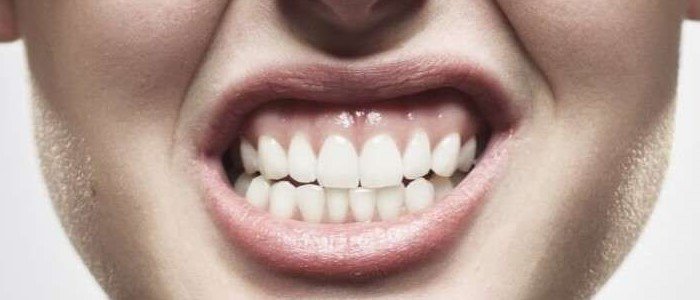 ALL YOU NEED TO KNOW ABOUT BRUXISM
