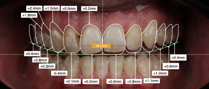 DESIGNING YOUR DREAM SMILE AT STUDIO DENTALE