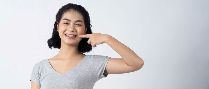 From Braces to Brilliance: Maintaining Your Beautiful Smile