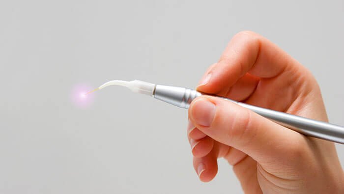 LASER DENTISTRY