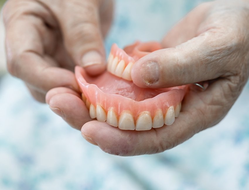 Dentures at Studio Dentale
