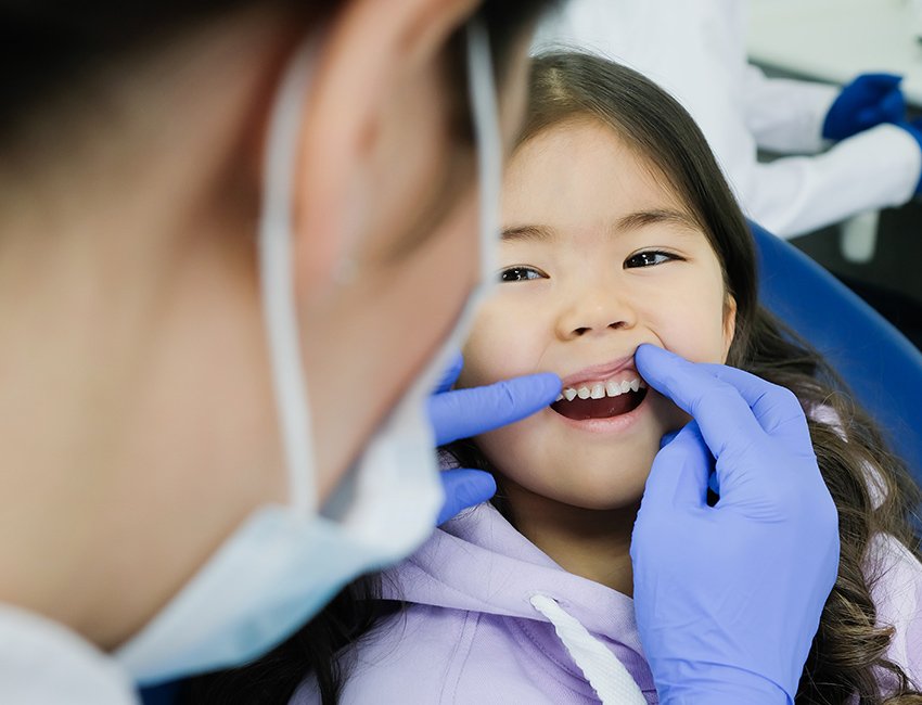 Fluoride Treatment at Studio Dentale