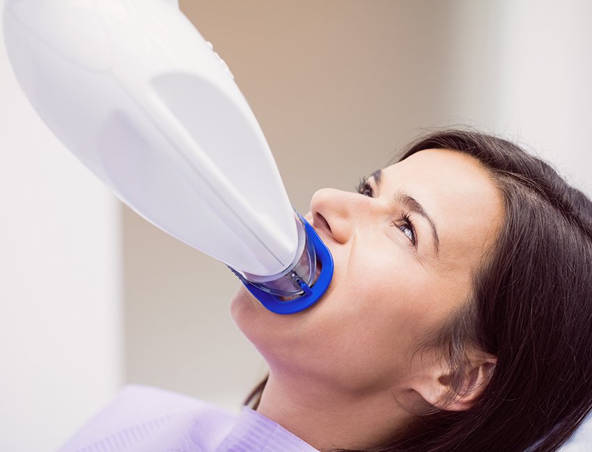 Laser-Assisted Teeth Whitening at Studio Dentale