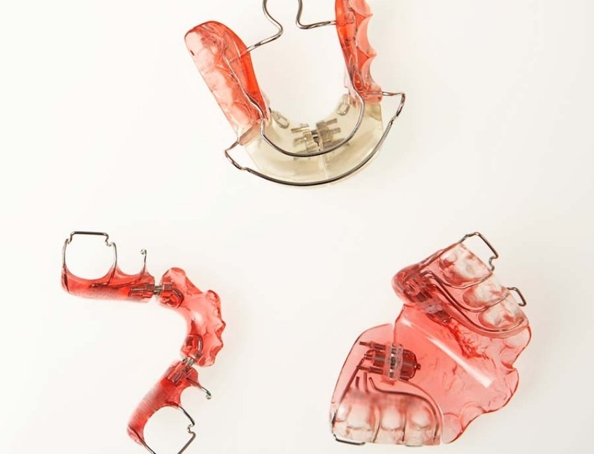 Malocclusion Treatment at Studio Dentale