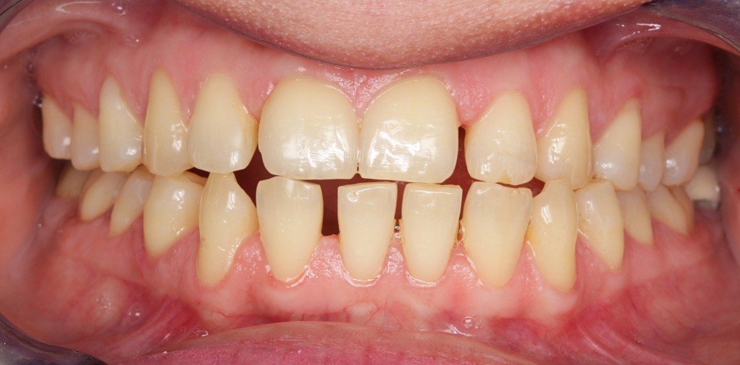 Before transformation