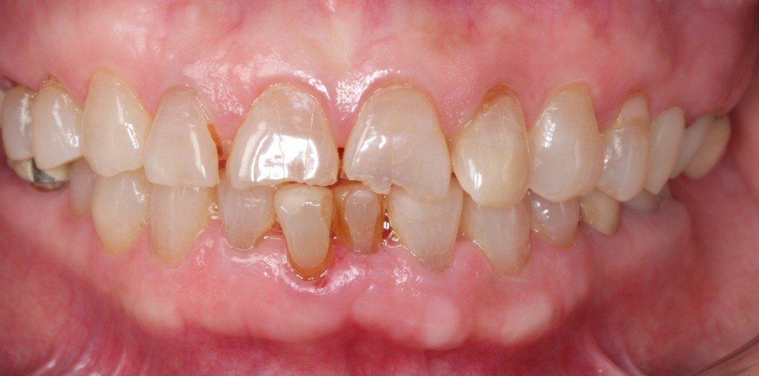 Before transformation