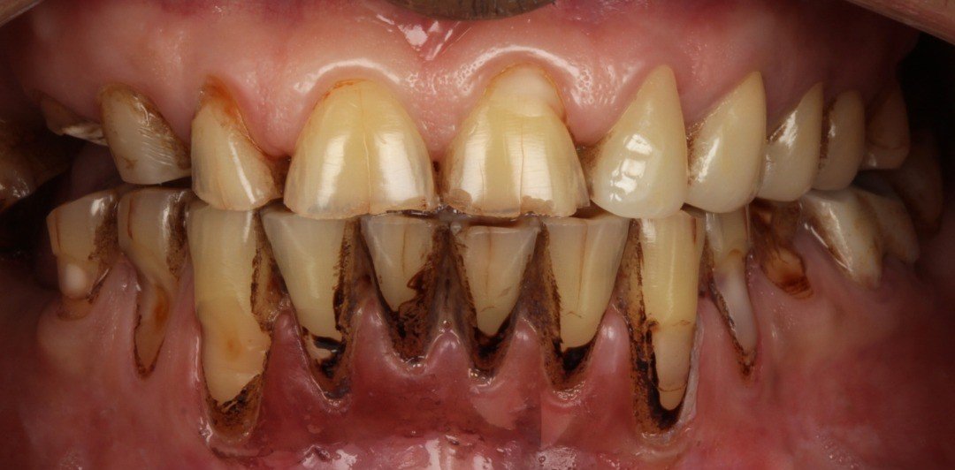 Before smile transformation