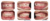 Dental Implants In Kathmandu, Nepal
