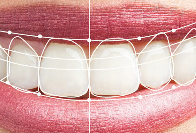 Digital Dentistry in Nepal