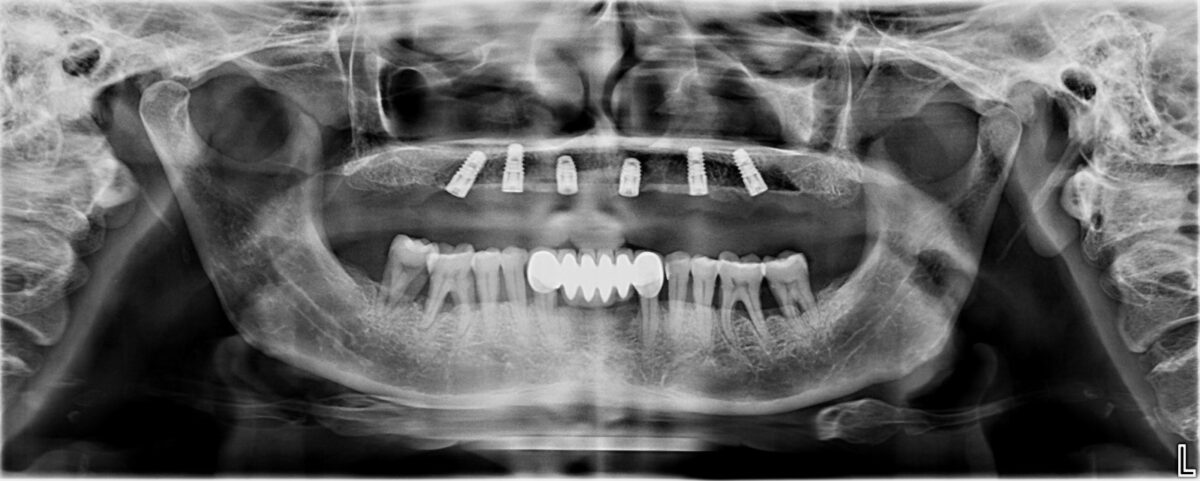 dental x-ray