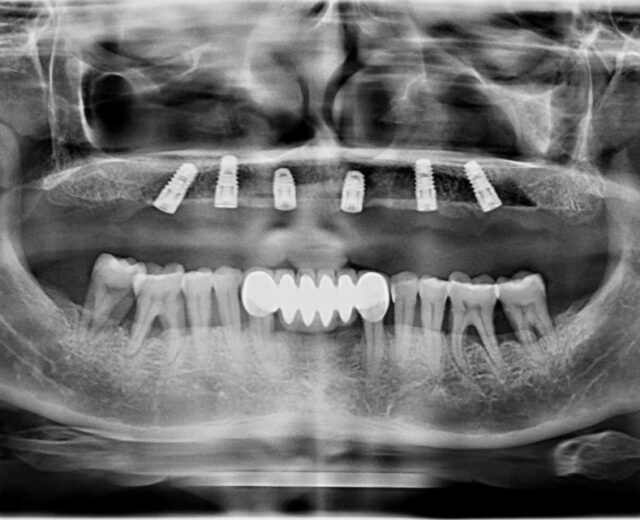dental x-ray
