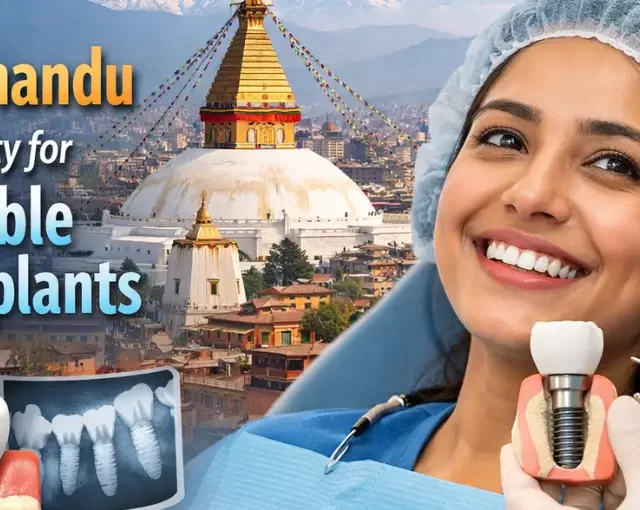 Dental implant in Kathmandu