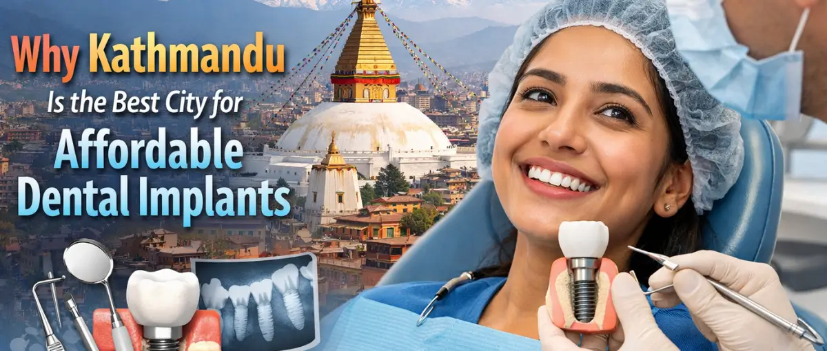 Dental implant in Kathmandu