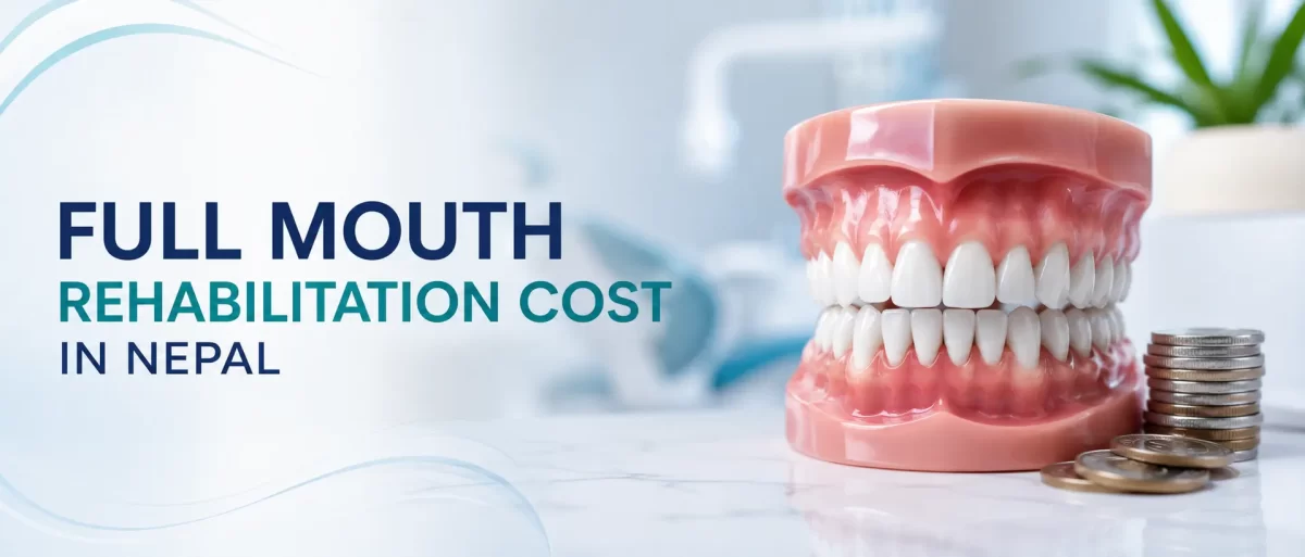 Full Mouth Rehabilitation Cost in Nepal