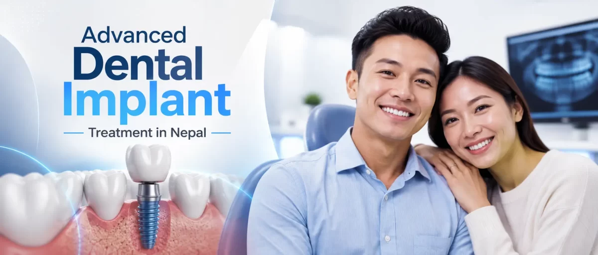 Advanced Dental Implants in Nepal