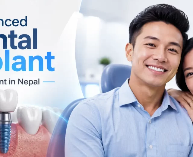 Advanced Dental Implants in Nepal